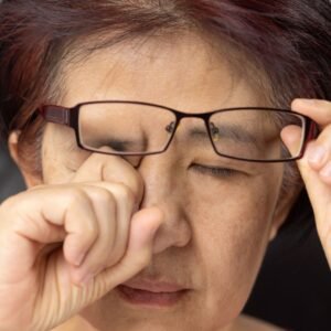 Periorbital Oedema: Can Kobido Help Reduce Under-Eye Bags?